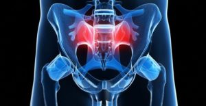 sacroiliac joint dysfunction