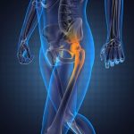 hips joint pain