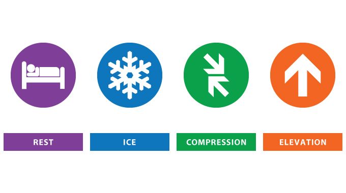 rest ice compression elevation