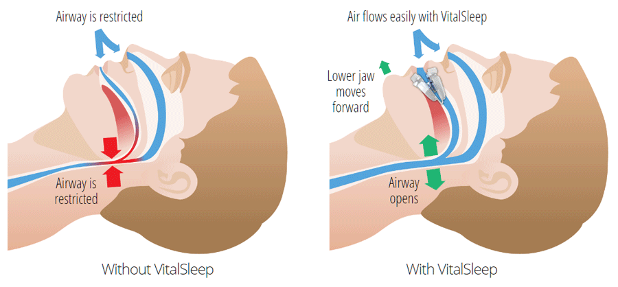 vitalsleep how it works